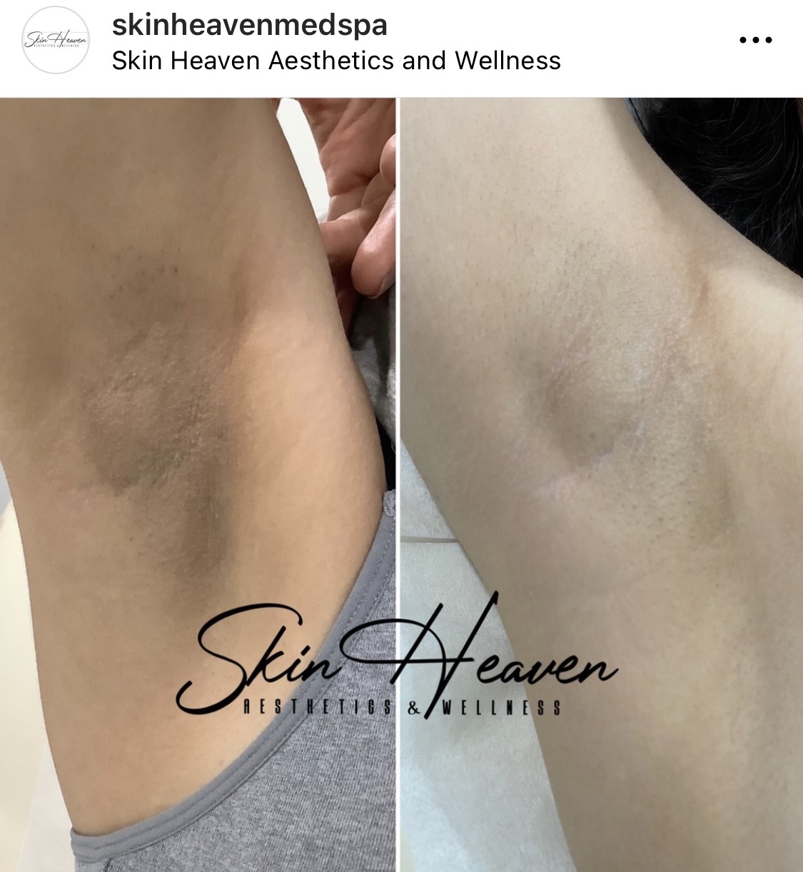 Skin Heaven Aesthetics and Wellness