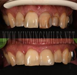 WinningSmiles Custom Dentistry & Implant Center