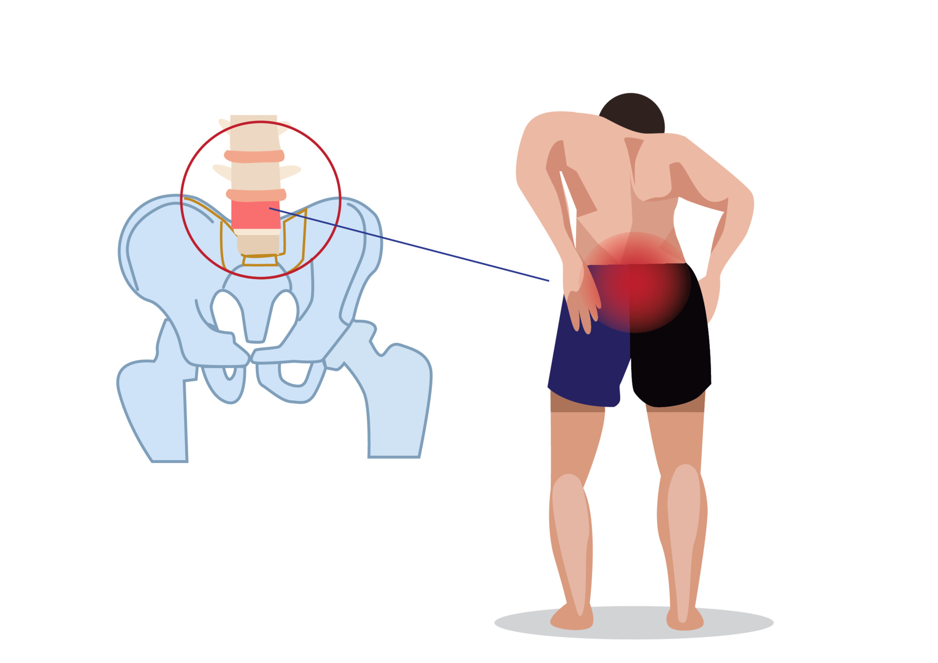 Painless Trigger Point