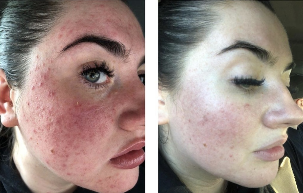 Laser Skin Solutions Motcombe