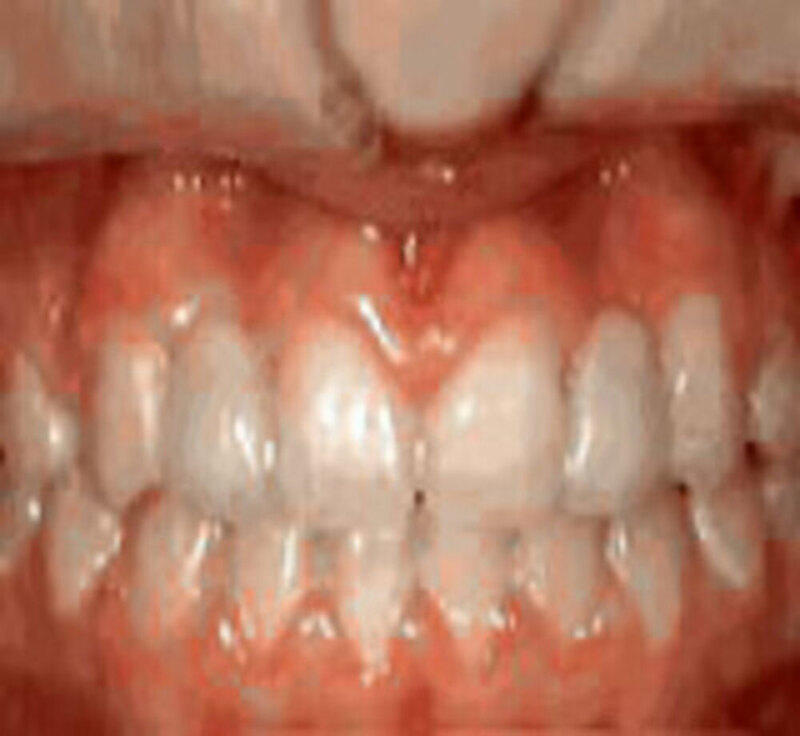 Marsh Orthodontics - William F Marsh DDS
