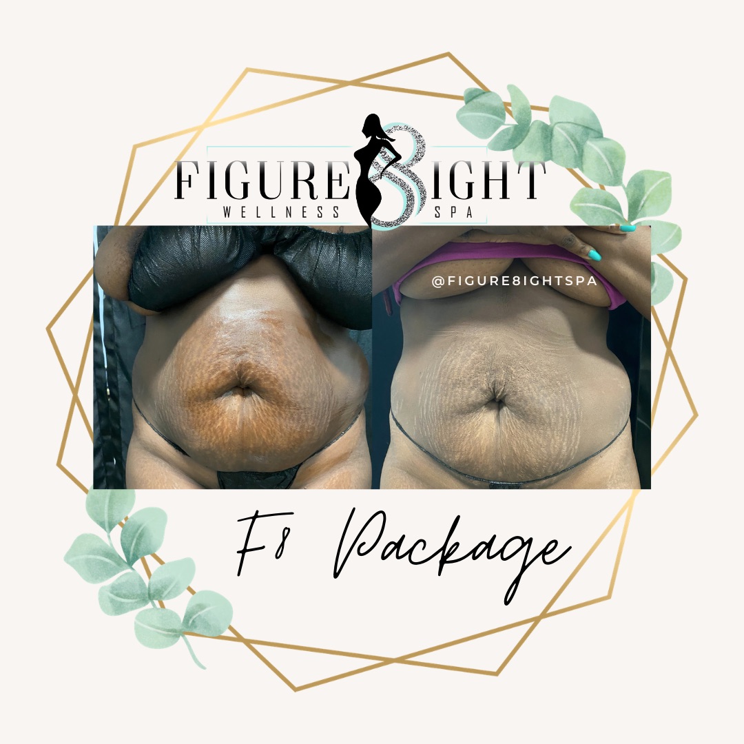 Figure 8ight Wellness Spa