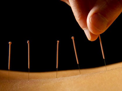 Root Health-Acupuncture & Chinese Herbs