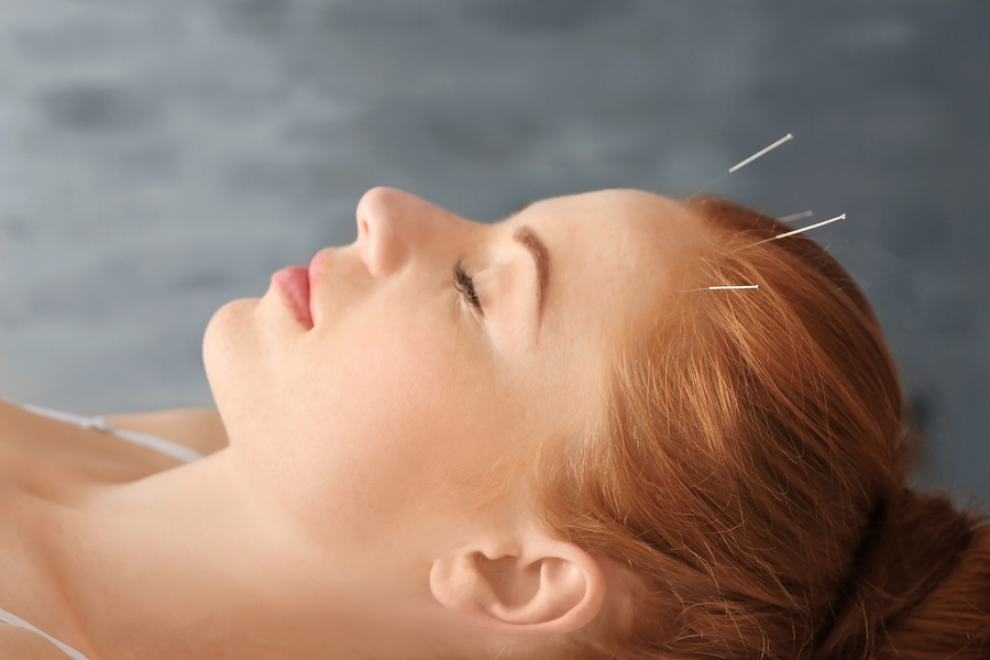 Bodyscapes Acupuncture