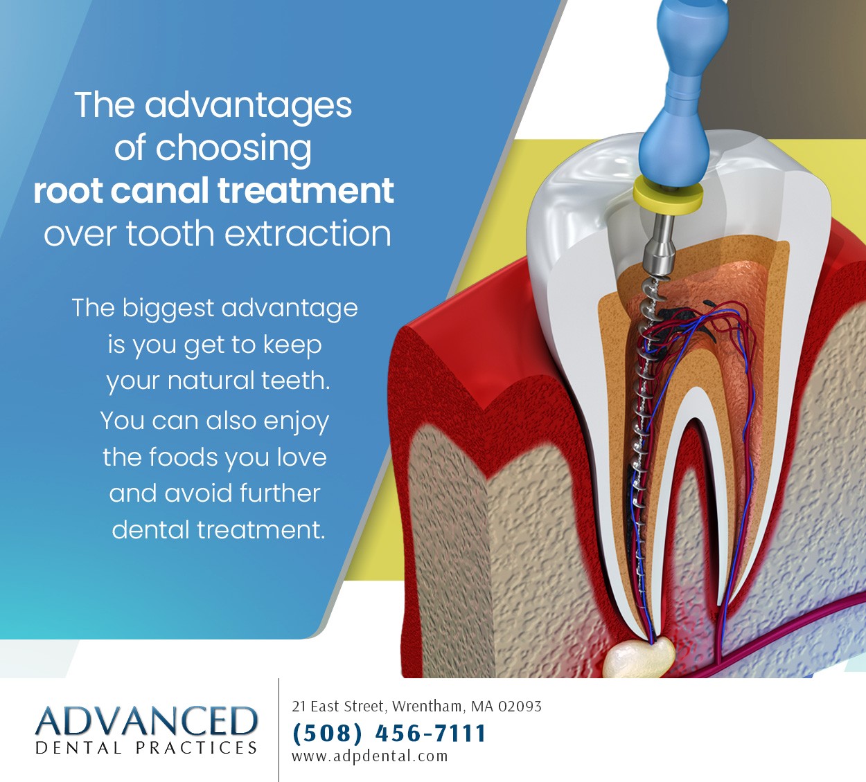 Advanced Dental Practices 21 East St, Wrentham Massachusetts 02093