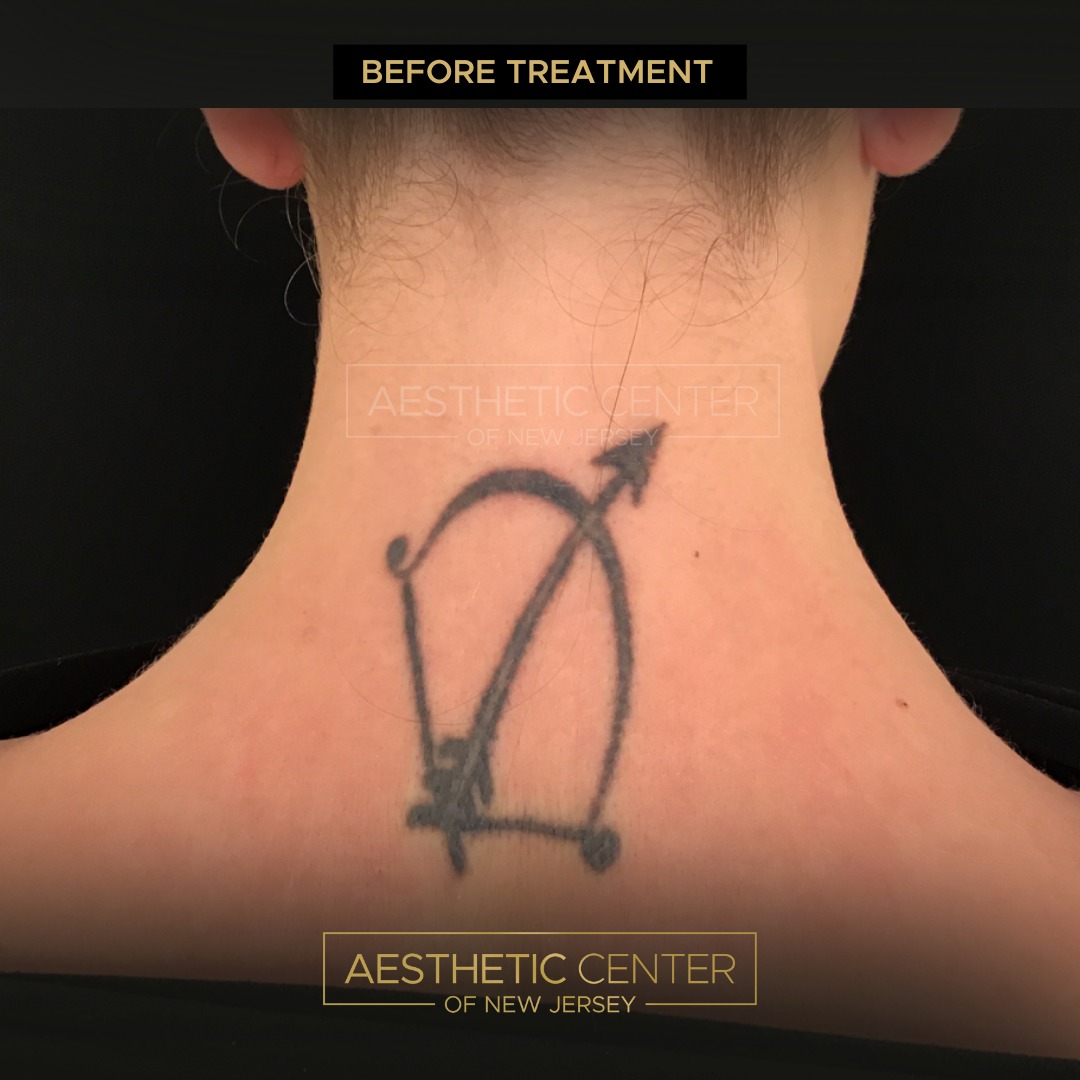 Aesthetic Center of New Jersey 794 Franklin Ave, Franklin Lakes New Jersey 07417