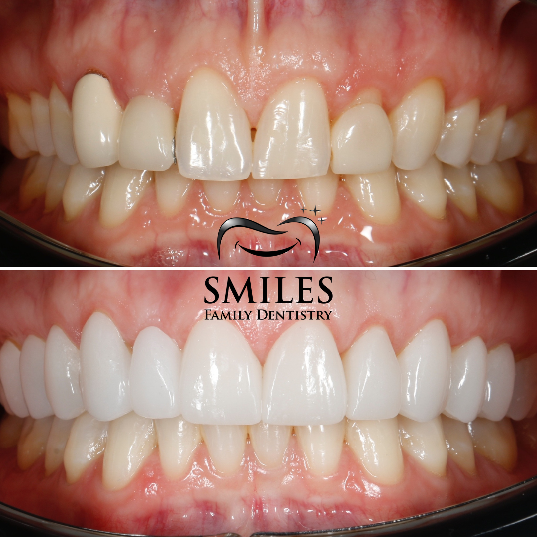 Brunswick Smiles Family Dentistry | Family, Implant & Cosmetic Dentist in Brunswick New Jersey