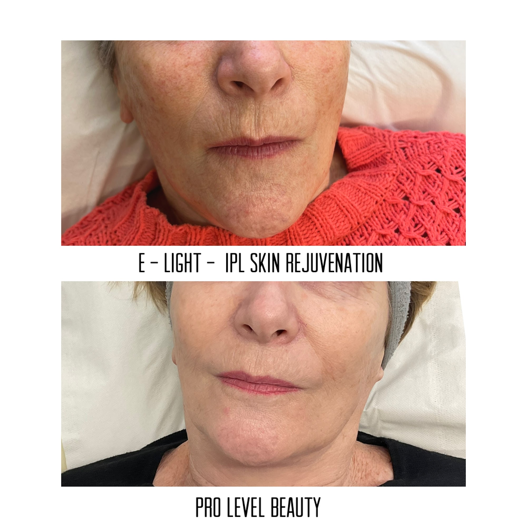 Pro Level Beauty & Laser Clinic