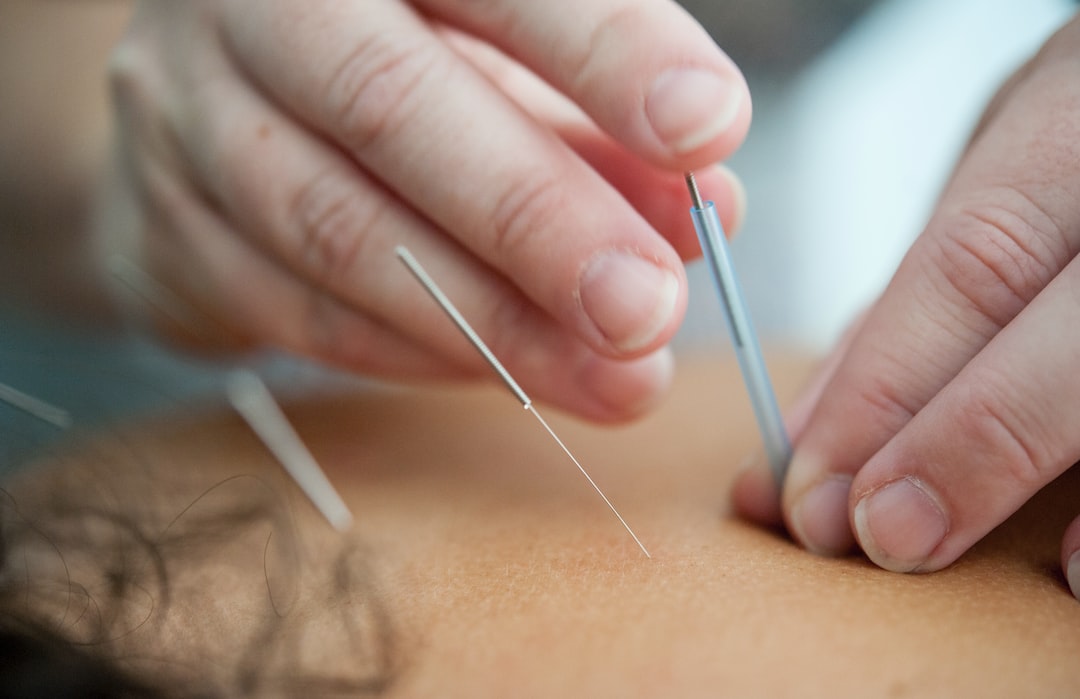 Eastern Natural Therapy Center with Acupuncture and Massage