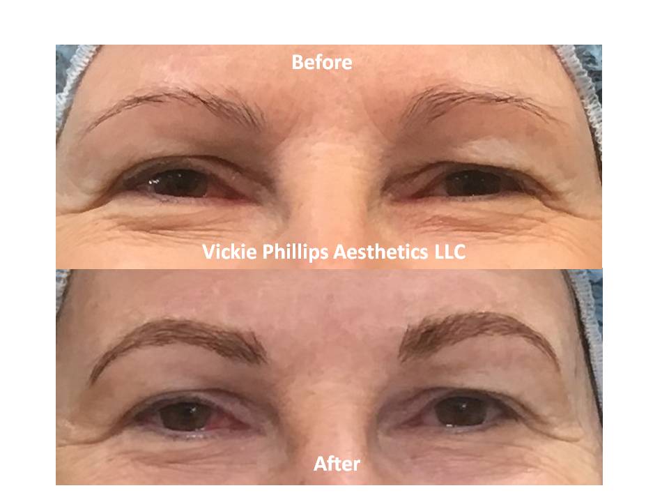 Vickie Phillips Aesthetics LLC