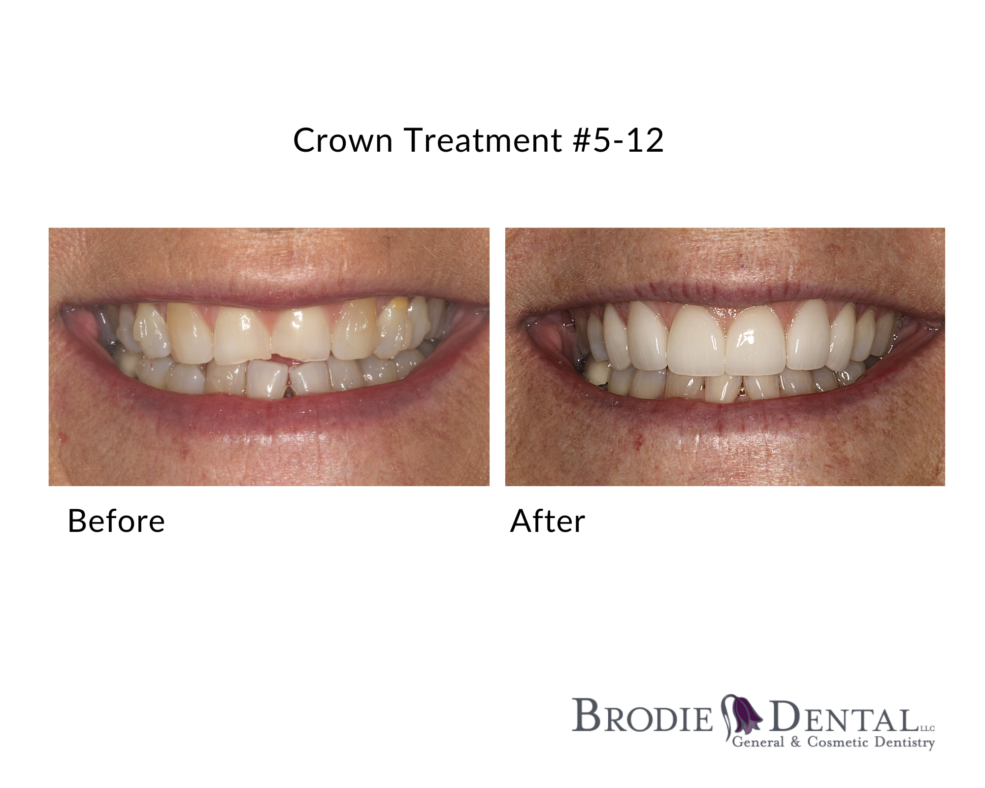 Brodie Dental LLC 305 Shafer Ln, Jacksonville Oregon 97530