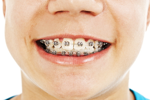 Element Dental & Orthodontics Conroe
