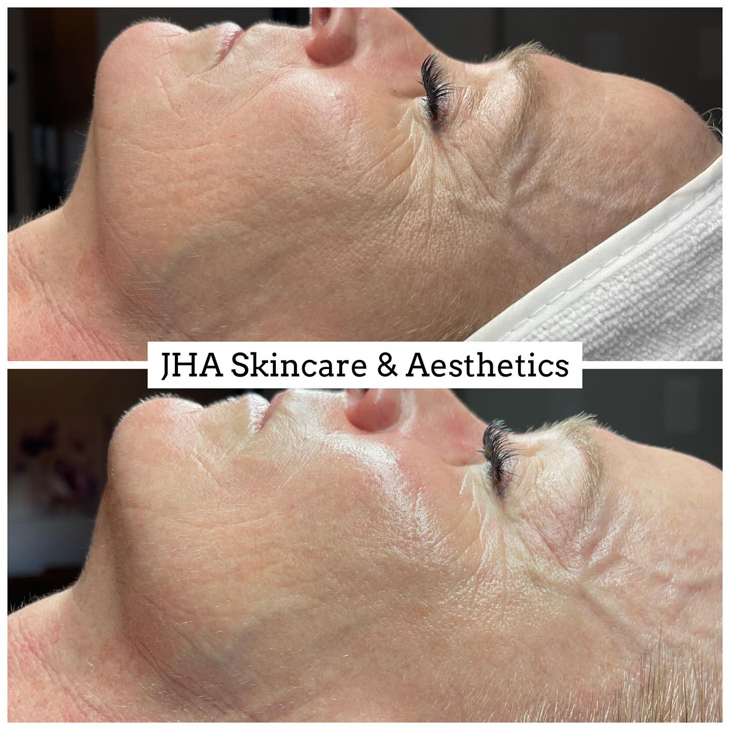 JHA Skincare & Aesthetics 3384 W 4600 S Suite 3, West Haven Utah 84401