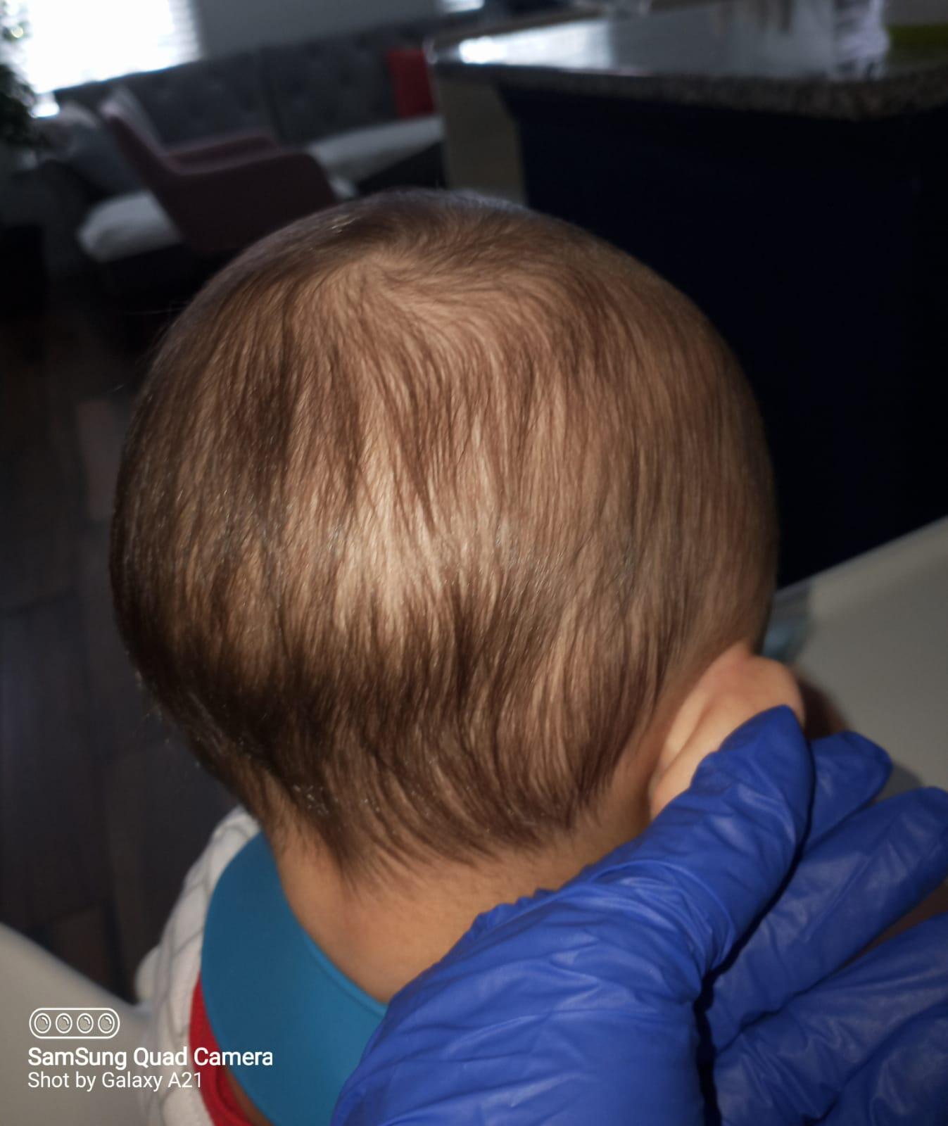 Lice's Doomsday Lice Treatment and Removal Service Virginia Beach