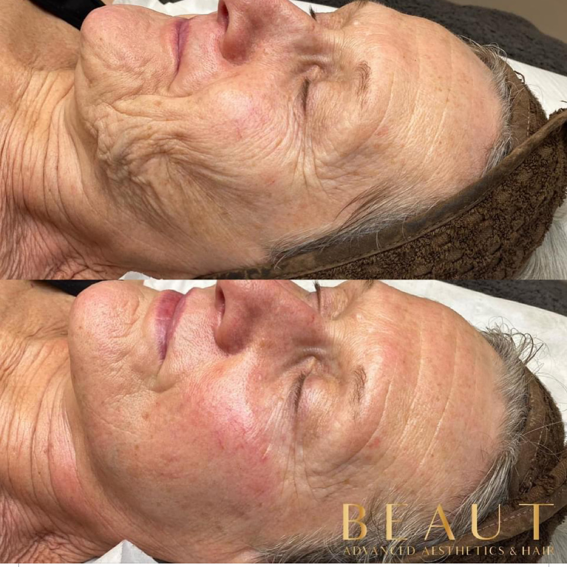 Beaut Transformation Clinics