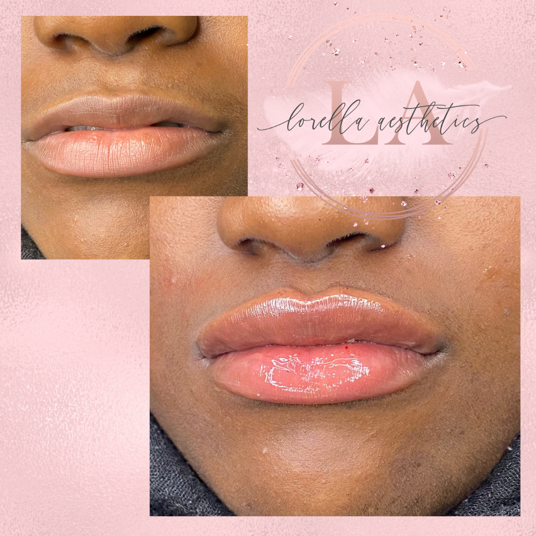 Lorella Aesthetics Dudley